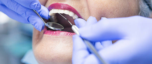Best Emergency Broken Tooth Repair in , FL